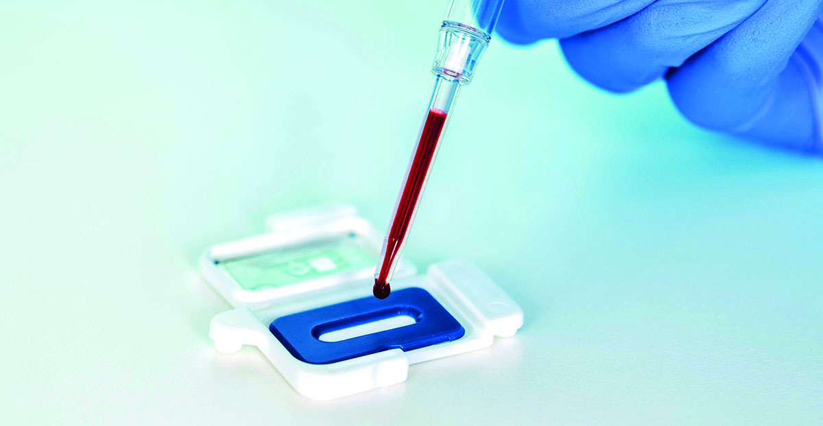 Le secteur des technologies médicales croît, malgré certains obstacles à son développement, comme les difficultés avec l\u2019Union européenne. 